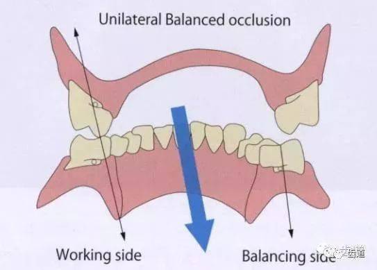 关于禾平衡的全口义齿咬合论战(全文)_平面
