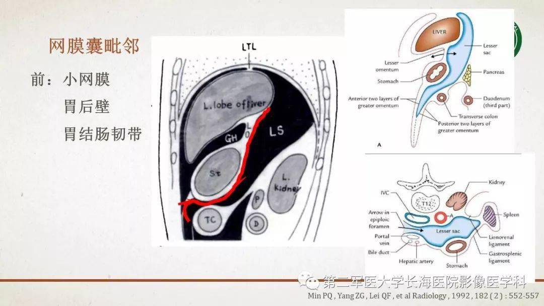 腹膜相关结构的影像解剖