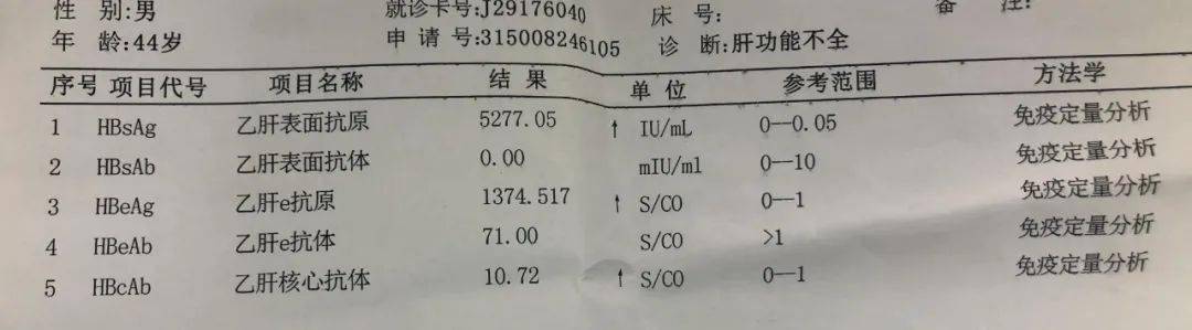 乙肝严重不严重不要只看表面抗原和病毒dna还需要了解这些检查