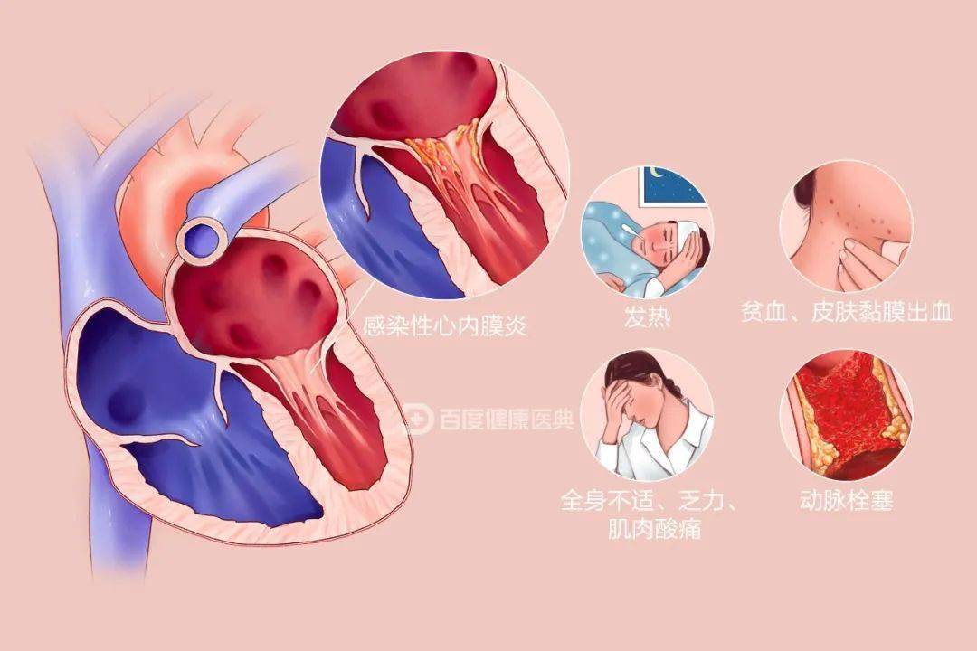 一颗"蛀牙,居然搞坏杭州大伯的心脏!