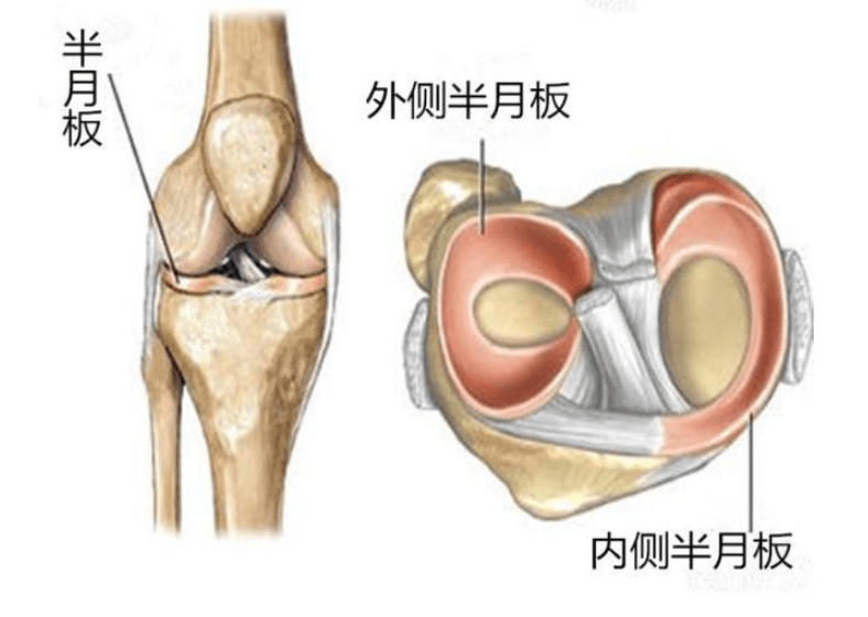 薇娅,汪苏泷都中招,别忽视半月板发送的求救信号