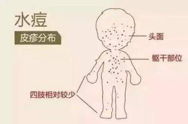 一颗水痘的独白 |又是一年战"痘"季,快来看看对手什么