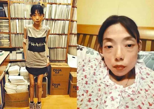 史上最惨前妻22岁嫁入豪门被抛弃后瘦成纸片人