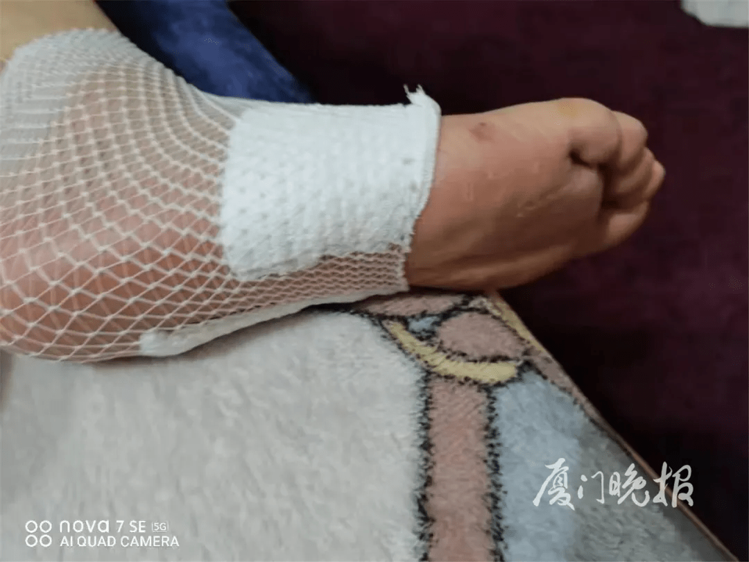First Aid Treatment for a Puncture Wound