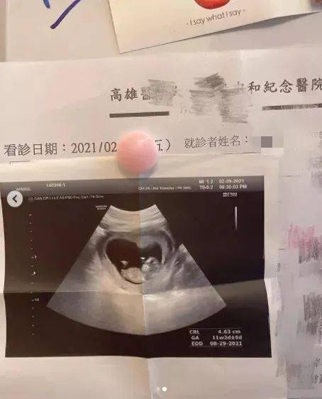 12周胎儿男生殖突出,男胎儿小鸡与女胎区别 第一张她拿着宝宝b超照片,她说自己怀孕12周,小腹隆起,男友站在她后面