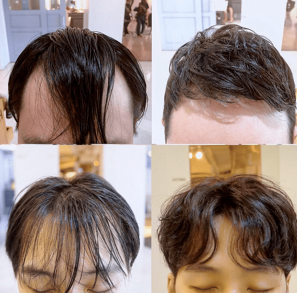 男士发量少该怎么选发型