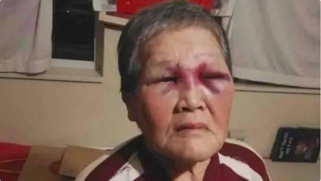 「停止仇恨 亚裔」:吴彦祖陈冠希联手,这次不能忍了