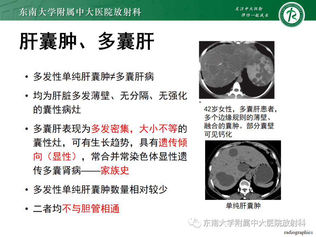 caroli病鉴别诊断