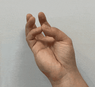 该病多发于单侧手掌,多有手指手腕无力,拇,食,中指和半个无名指的