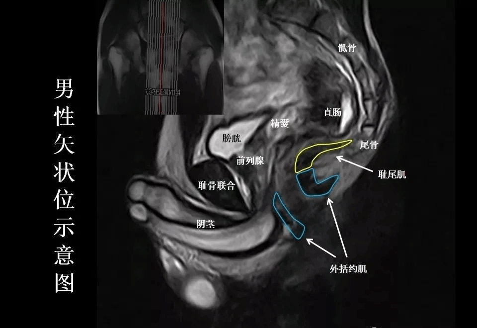 8张图让您熟悉盆底mri解剖