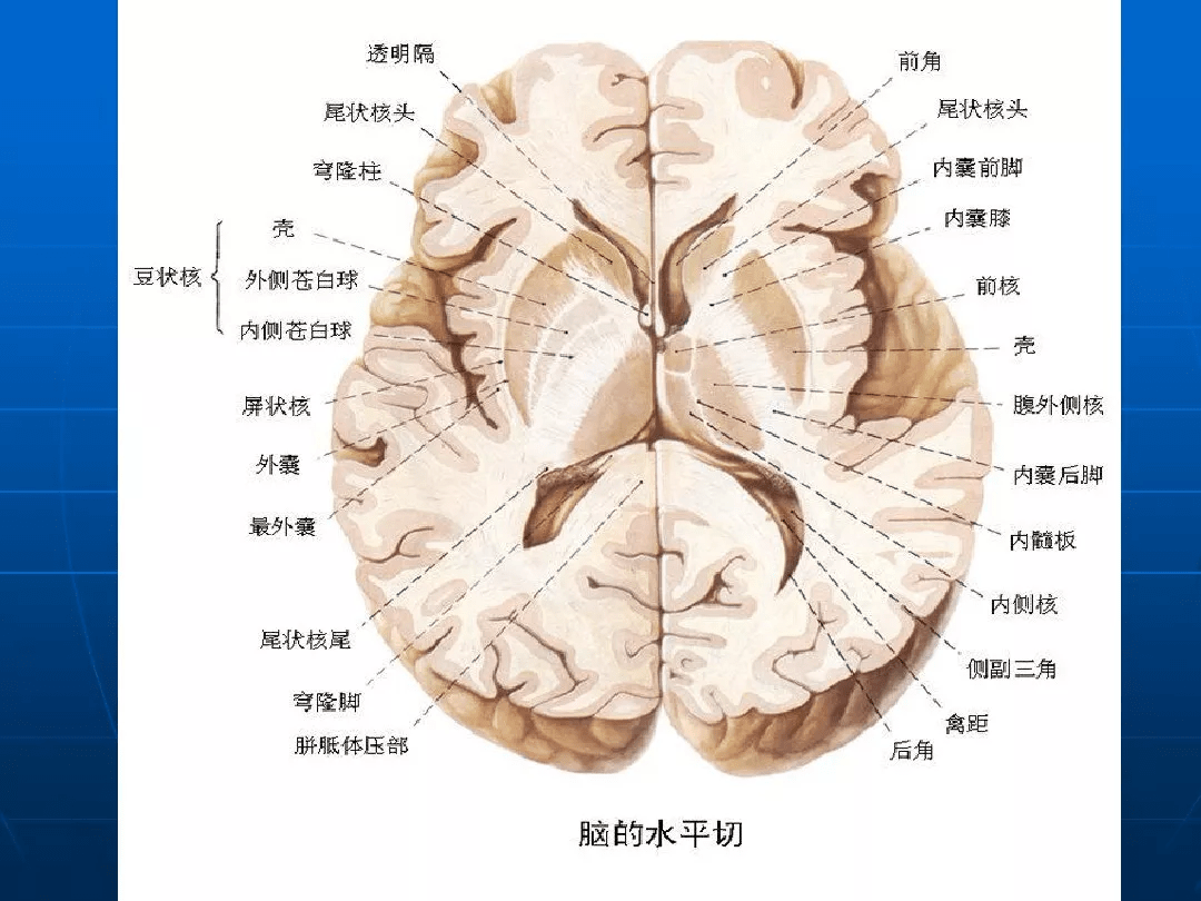 影像总结:头颅ct基本知识与常见病变