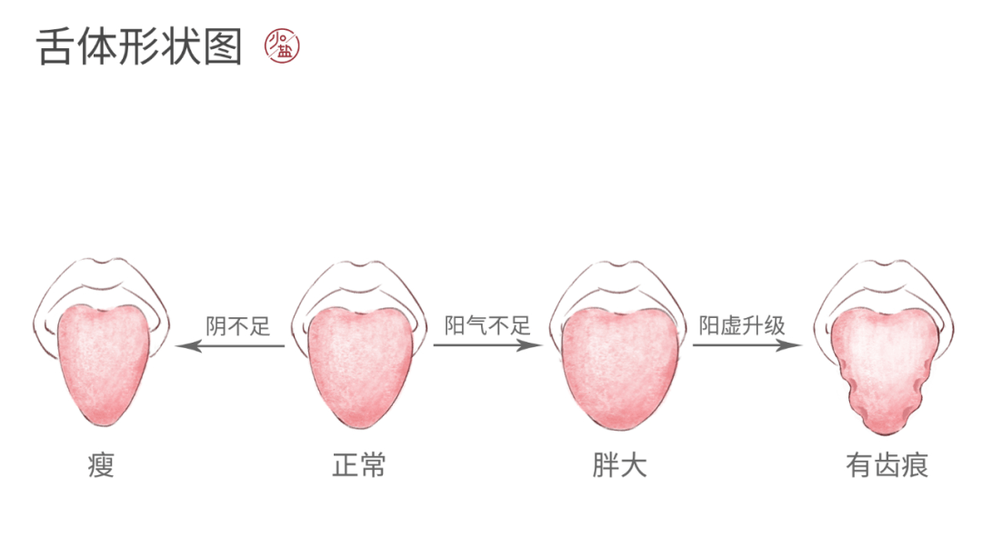 一看就会的舌诊法1分钟辨别体质