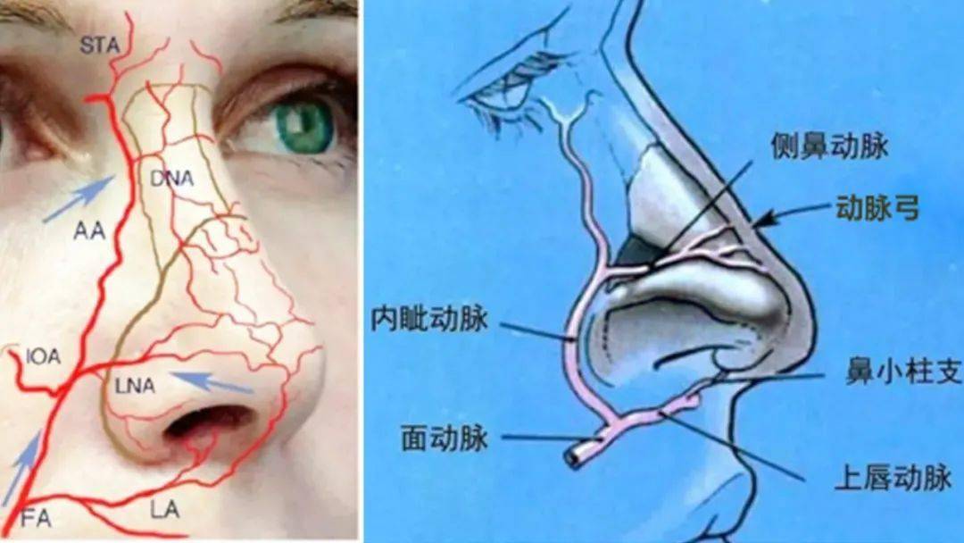 隆鼻技术想了解你的鼻子先认识鼻部结构形态及鼻部截骨