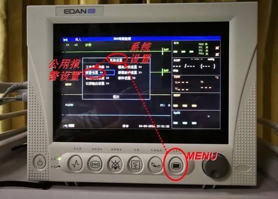 心电监护仪从早滴到晚?调好报警设置,安全又安静!