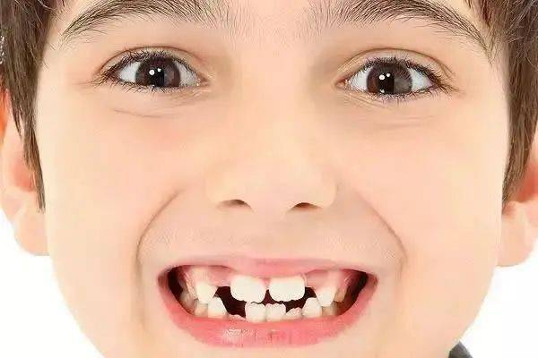 学术分享 12岁前儿童牙颌畸形的早期疗效观察_牙齿