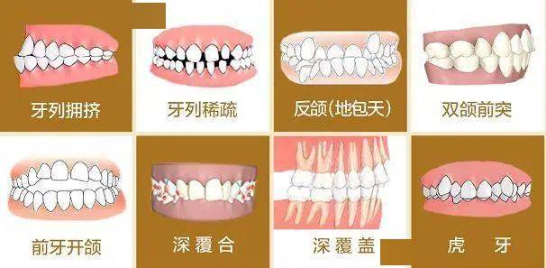 如何预防牙颌面畸形?