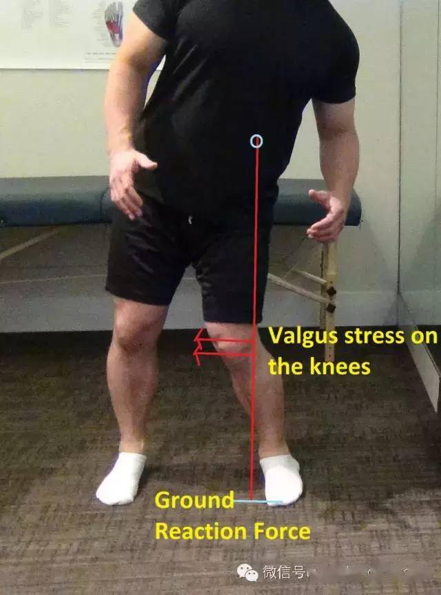 「膝关节②」膝韧带-损伤预防与康复训练