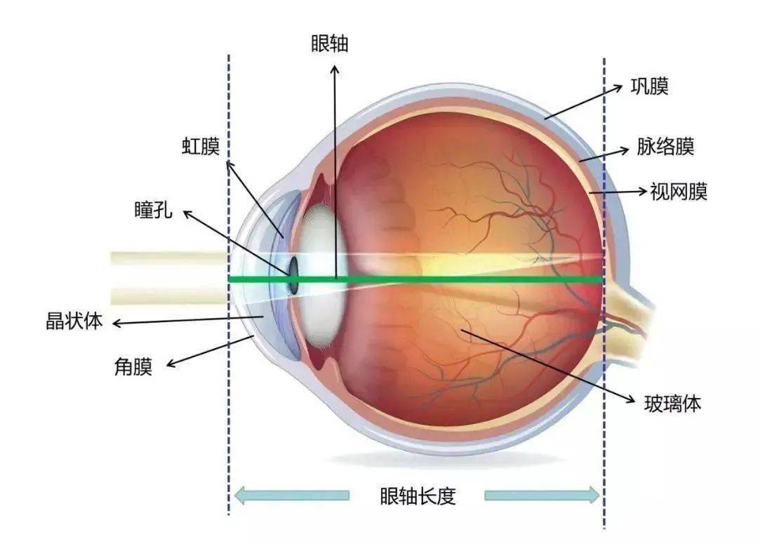 视神经鞘扩张和视盘水肿