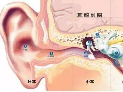 耳膜破裂后,患者突感耳痛,听力立即减退伴耳鸣,外耳道少量出血和耳内
