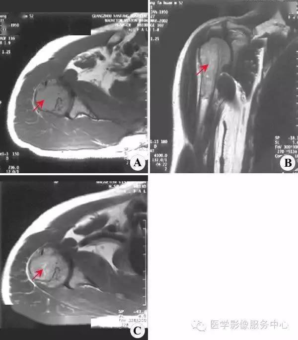 一文看懂 | 典型骨肌病例(x ct mr)
