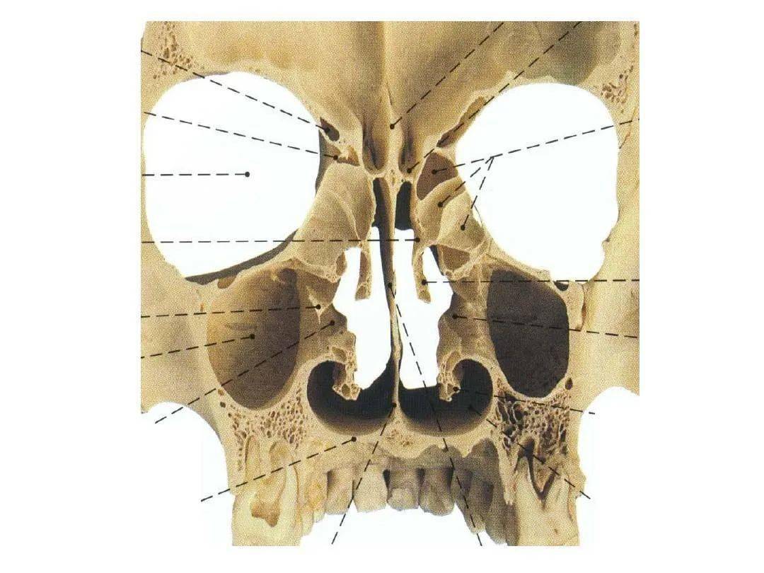 鼻及副鼻窦影像解剖