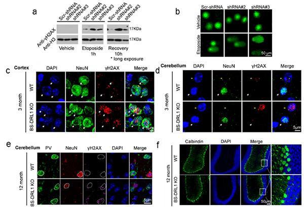 lncrna bs-drl1参与调控dna损伤并造成浦肯野细胞丢失