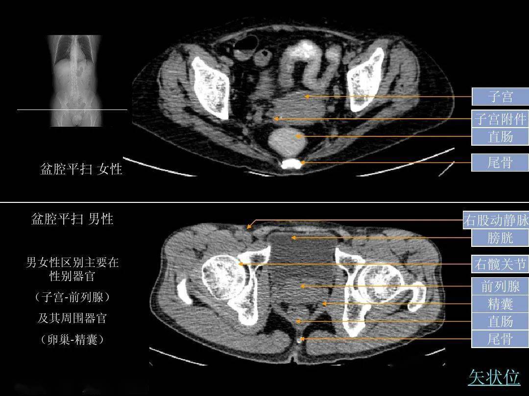 超细的腹部ct应用入门必备手册(原理 精美解剖图谱)