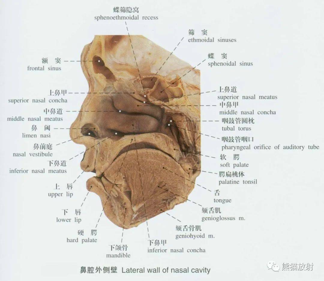 系统解剖标本图谱丨呼吸系统
