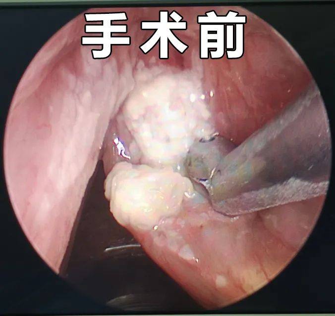 范国康主任医师介绍 喉癌是发生在喉部的恶性肿瘤,具体病因暂不明确.