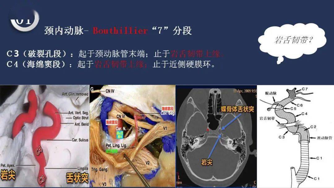 高清头颈动脉系统解剖