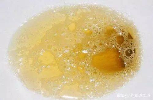 肝脏|睡觉时,出现3种异常,肝脏健康出了问题,莫忽视