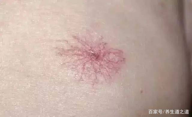 肝脏|睡觉时,出现3种异常,肝脏健康出了问题,莫忽视