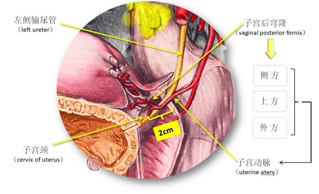 女性输尿管盆部位于卵巢的后下方,在经过子宫阔韧带基底部至子宫颈