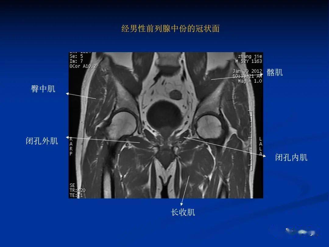 骨盆肌肉解剖_髋关节