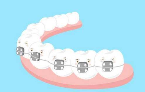 成人牙齿矫正和儿童牙齿矫正的区别