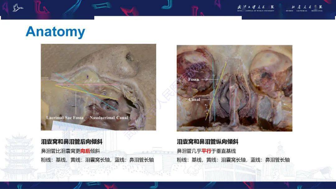 泪道病变影像诊断_全网_解剖图_系统