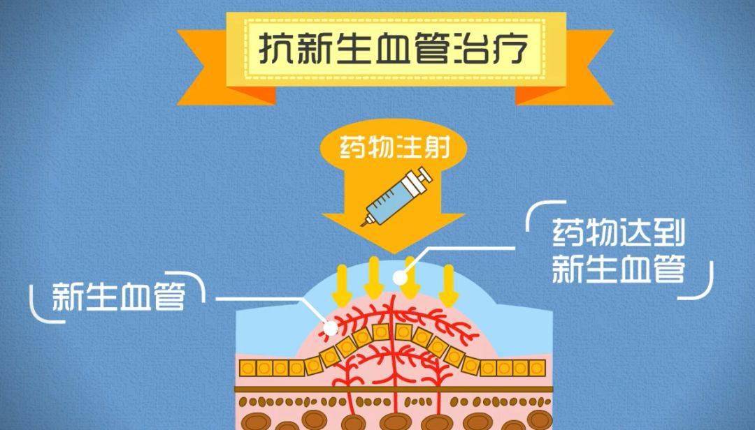 医生告诉你癌细胞是如何被"饿死的,抗血管生成药物大盘点_治疗_恶性