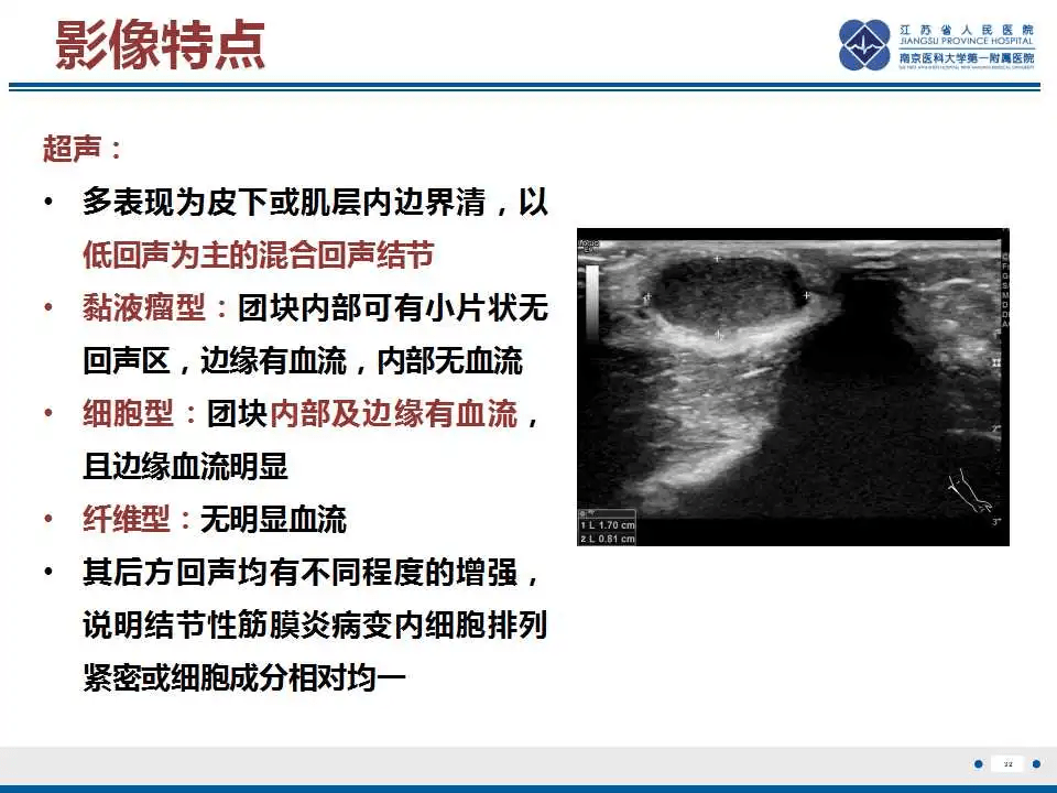结节性筋膜炎影像表现