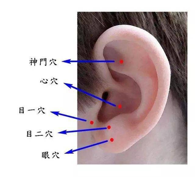 耳朵上出现这些特征,就要注意了_耳廓_耳穴_疾病