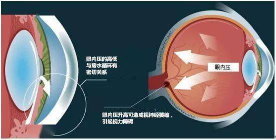 3眼压循环途径:由睫状体产生,进入后房,越过瞳孔到达前房,从前房的小