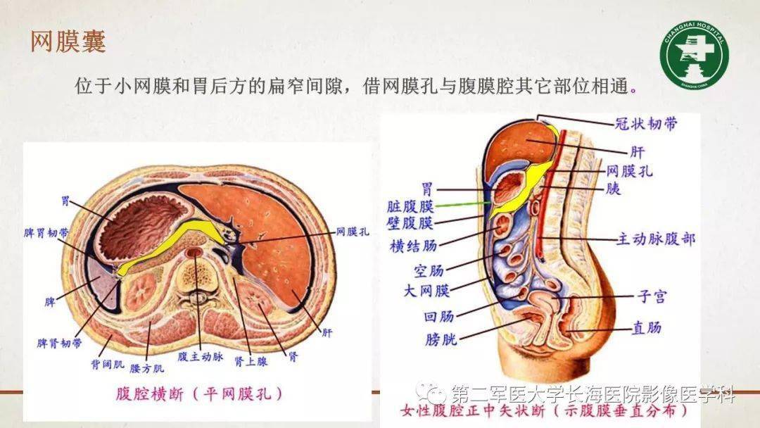 包罗万象的腹膜结构我们真的了解吗影像解剖