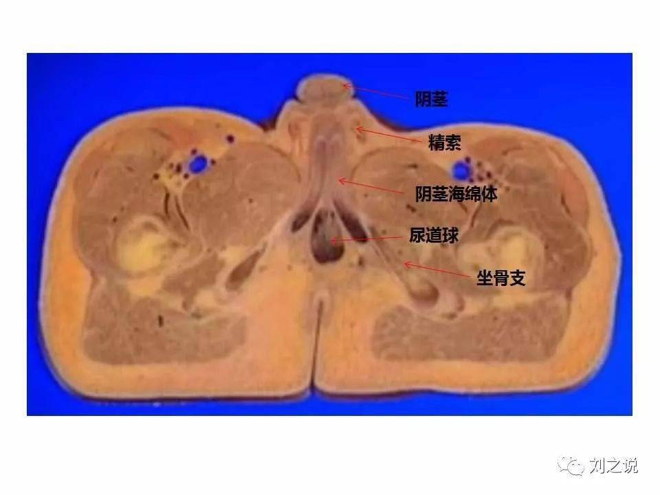 收藏必备男性盆腔断层解剖