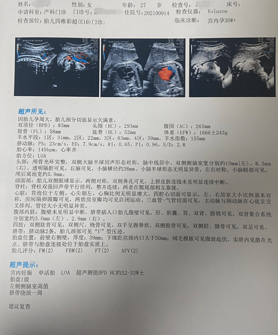 孕妈妈产检或b超结果异常这两位超强主任你得认识