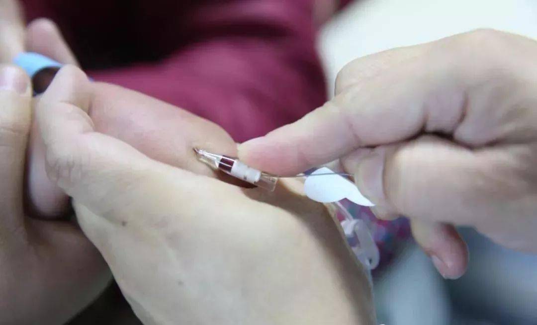 留置针穿刺新技能单手送管法提高成功率你get了吗