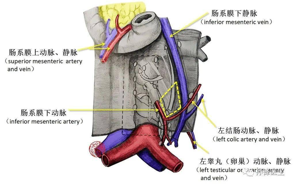 图(4):肠系膜下动脉根部的淋巴结分布(菱形区域)↑↑↑注意:结直肠癌