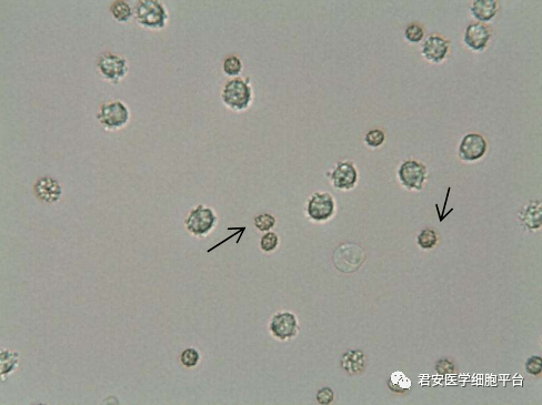 未染色 请报告箭头所指细胞名称粘液丝点击空白处查看答案未染色 请