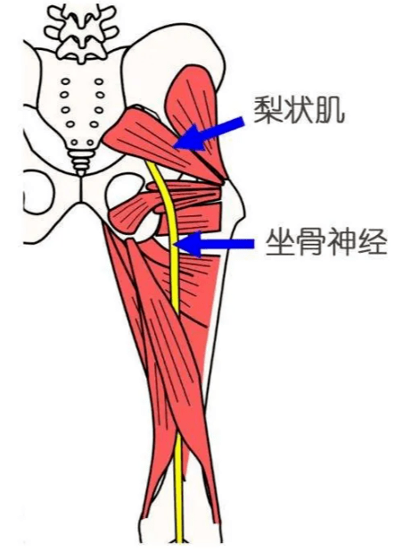 梨状肌区域疼痛属于骶丛神经支配,触诊骶丛支配区域寻找损伤,紧张