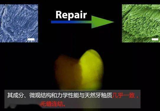 在实验中发现,牙釉质是可以修补的,一种叫做羟基磷灰石的成分,可以和