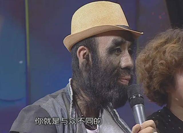 被研究的于震寰:有人花1000万包装他,42岁娶90后娇妻_孩子_毛发_毛孩