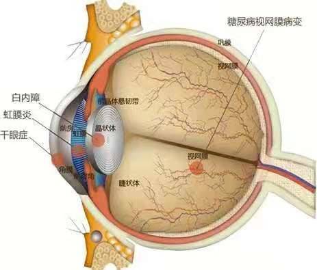 成都供卵机构有哪些（上海青光眼专家吴仁毅医生：青光眼手术什么时候做合适？）